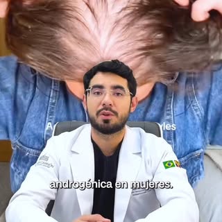 Comparte este video a quien esté pasando por este caso de #alopecia y síguenos para más contenido co