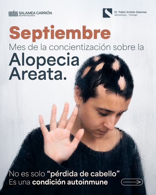 Septiembre no puede pasar desapercibido🙌🏻

Este mes es para concientizar y aprender sobre #alopeci
