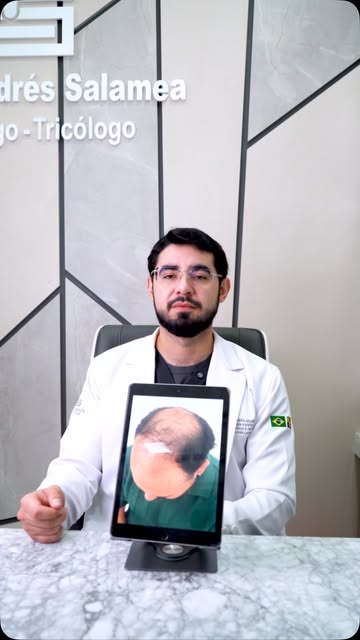 Soy el Dr. Pablo Andres Salamea, y mi única misión es acabar con esos problemas de cabello 👋🏻😎

S