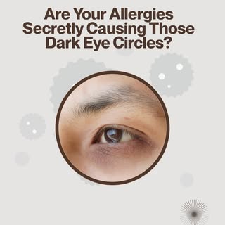 𝐖𝐡𝐚𝐭 𝐚𝐫𝐞 𝐀𝐥𝐥𝐞𝐫𝐠𝐢𝐜 𝐒𝐡𝐢𝐧𝐞𝐫𝐬? 𝐀𝐧𝐝 𝐡𝐨𝐰 𝐝𝐨 𝐚𝐥𝐥𝐞𝐫𝐠𝐢𝐞𝐬 𝐜𝐨𝐧𝐭𝐫𝐢�