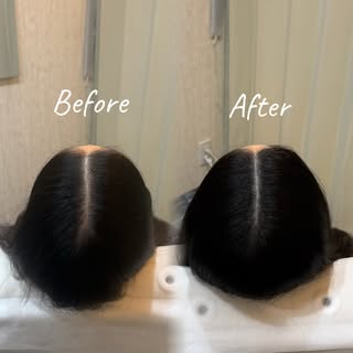 分け目を整えて、いつもの髪をもっと綺麗に🌿

「なんとなく分け目が気になる」
「写真を撮ると、分け目が目立つ気がする」
そんな日常のちょっとしたお悩みに。

頭皮アートメイクで分け目に自然なドットを