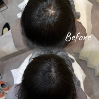 2回目施術後のBefore / After✨

1回目の施術からさらに色味と密度を整え、より自然な仕上がりへ。

回数を重ねながら、少しずつドットを重ねていくことで、自然な密度感を目指します🌿

�