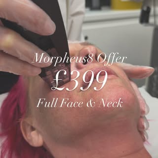 ✨ Morpheus8 Full Face & Neck – £399 ✨

If you’ve been thinking about Morpheus8, there’s never been a