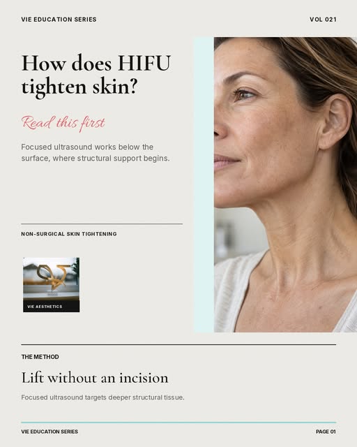 𝗛𝗼w 𝗗𝗼𝗲𝘀 𝗛𝗶𝗙𝗨 𝗧𝗶𝗴𝗵𝘁𝗲𝗻 𝘁𝗵𝗲 𝗦𝗸𝗶𝗻?

HIFU works below the skin’s surface. Focuse