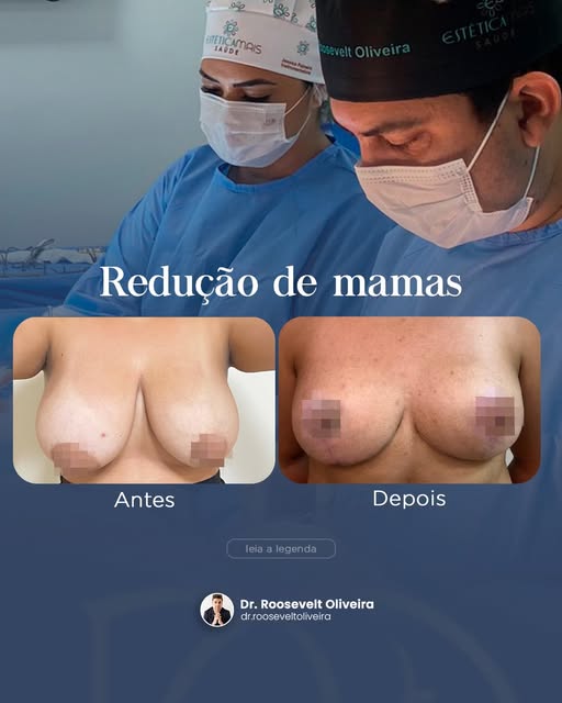 Por que realizar uma cirurgia mamária?

A cirurgia pode ser indicada para pacientes que apresentam a