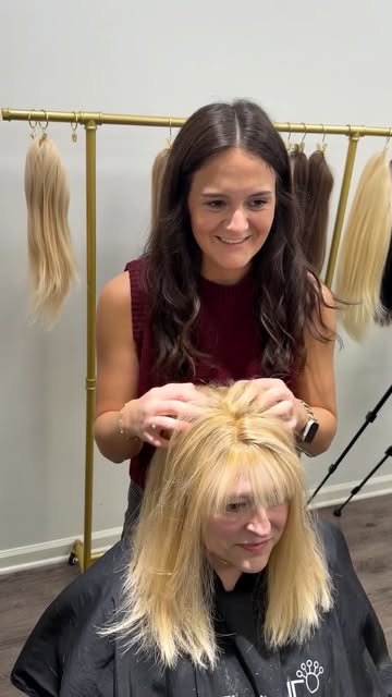 She came in with significant hair loss on top….and left with a beautiful, natural-looking transforma