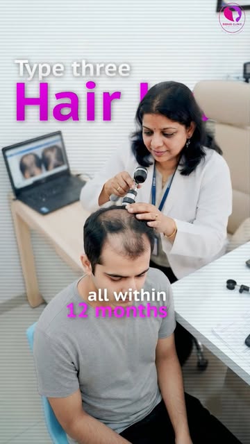 Are you waiting for your hair fall to magically stop on its own? Here’s why that delay is costing yo