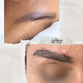 Greffe de sourcils cheveux longs Long Hair FUE 
Sans rasage sans cicatrice 
Avant après 
(+216)53458