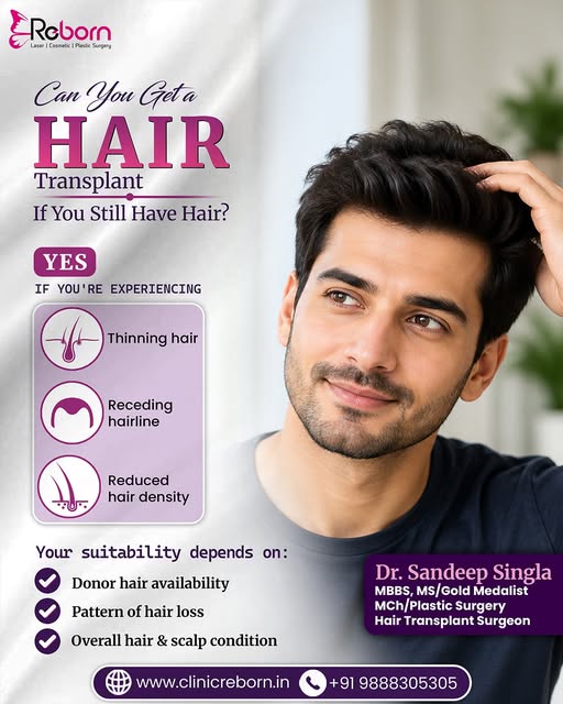 Still have hair but noticing your hairline changing or your scalp looking more visible? 👀

A hair t