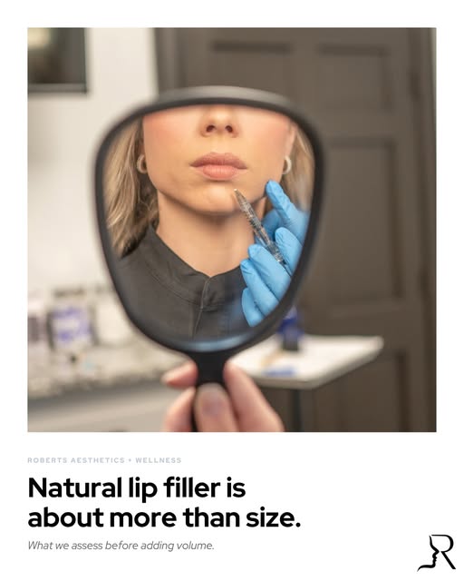 Natural-looking lip filler is not measured by size alone.

We look at proportion, symmetry, border s