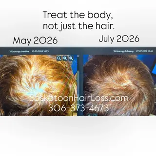 Considering what's happening in your whole body and not just your hair loss is our specialty. 

We l