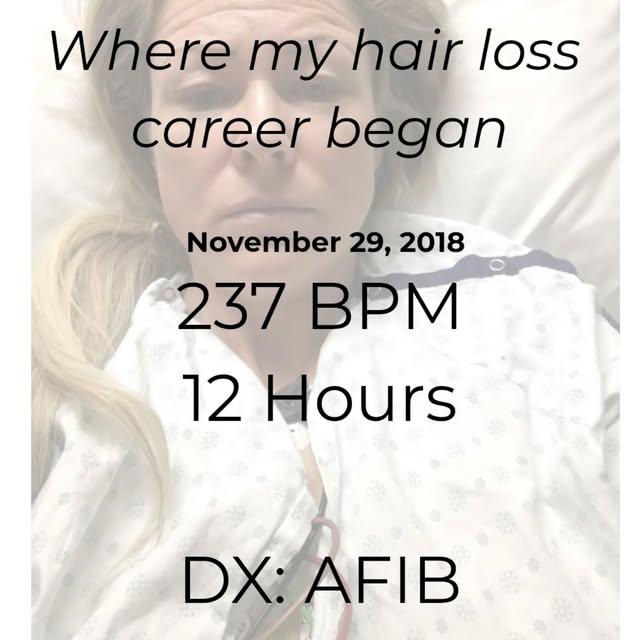 November 29, 2018. 237 BPM. 12 hours in the ER. Diagnosed with AFib.

I thought that was the scary p