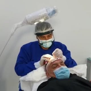 Trasplante capilar método FUE en proceso de incisiones previas a la implantación.

✅Consulta siempre