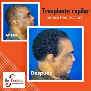 @hairdoctorscolombia Te invita a conocer nuestros servicios de la más alta calidad, lo último en tec