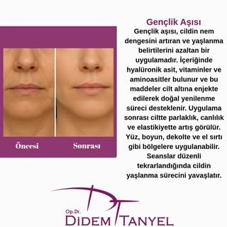 👩🏻‍⚕️ Op. Dr. Didem Tanyel - Estetik ve Plastik Cerrahi 

Bilgi ve Randevu için;
☎️0312 467 00 70
