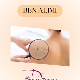 Bilgi ve Randevu için;
☎️0312 467 00 70
📞0551 797 00 70 

www.didemtanyel.com 
info@didemtanyel.com