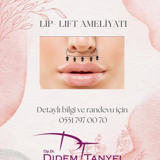 Bilgi ve Randevu için:
☎️0312 467 00 70
📞0551 797 00 70 

 
#lipliftankara #liplift #dudak