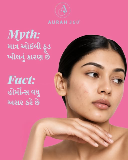 Food plays a role, but it's not the main driver. Hormonal changes, stress and the wrong skincare rou
