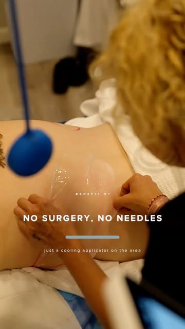 What CoolSculpting actually is, and who it is actually for.
It is not weight loss. If you are thirty