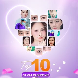🔥 TOP 10 CA CẮT MÍ + GHÉP MỠ – COMBO “CỨU TINH” CHO ĐÔI MẮT HỐC HÁC, THIẾU SỨC SỐNG
Không phải cứ c