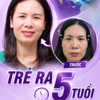 😍 "HACK TUỔI" ẤN TƯỢNG VỚI 10 PHÚT ĐỘN THÁI DƯƠNG TẠI DR HOÀNG TUẤN
Chỉ một vùng thái dương hóp cũn