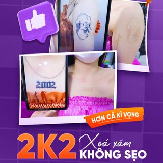 ✨ 2K2 XOÁ XĂM KHÔNG SẸO: BẮT ĐẦU HÀNH TRÌNH MỚI ĐẦY RỰC RỠ! ✨
Từng rất yêu thích hình xăm của mình, 
