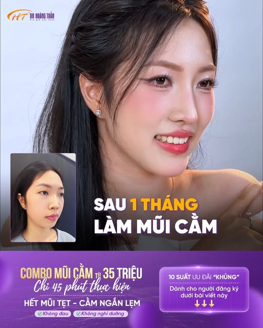 MŨI TẸT + CẰM NGẮN: ĐỪNG CHỈ SỬA 1 ĐIỂM 👉Làm combo mũi + cằm Dr Hoàng Tuấn, chỉ 45 phút để thay đổi