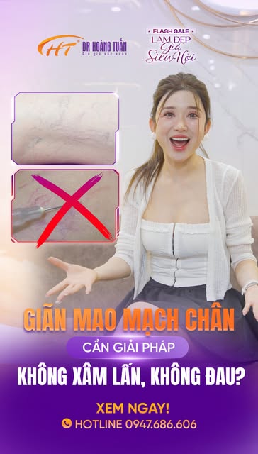 🎙️ MC THANH HUYỀN: "CẦN GIẢI PHÁP TRỊ GIÃN MAO MẠCH AN TOÀN - KHÔNG XÂM LẤN!"
Là một nữ MC luôn xuấ
