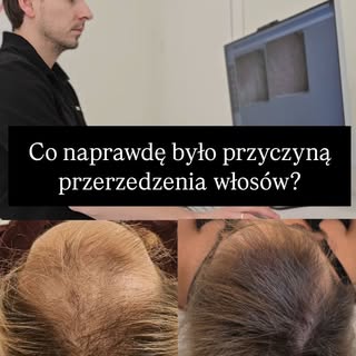 To nie zawsze stres.
Czasem problem jest głębiej.

Przez lata można szukać przyczyny w stresie, farb