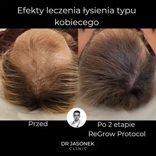 To nie zawsze stres.
Czasem problem jest głębiej.

Przez lata można szukać przyczyny w stresie, farb