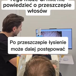 Przeszczep włosów nie zatrzymuje łysienia androgenowego.

ReGrow Protocol może natomiast pomóc odbud