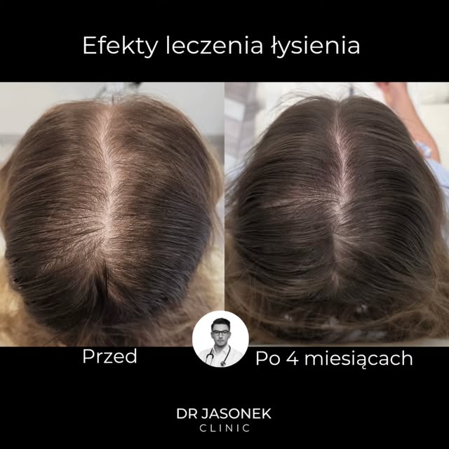Czasem największą zmianę daje nie kolejny kosmetyk, tylko wreszcie właściwe rozpoznanie.

Pacjentka 