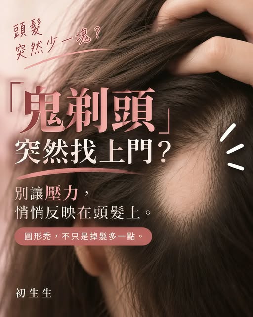 「等等……我這裡怎麼禿了一塊？」

很多圓形禿，
不是自己第一時間發現，
而是照鏡子、整理頭髮，甚至別人提醒才注意到。
突然出現，當然會慌。

但比慌更重要的是——先搞懂它

👉 往左滑，認識大家常