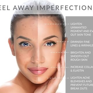 Meet the Perfect Derma Peel, our deepest peel option built to target hyperpigmentation, melasma, sun