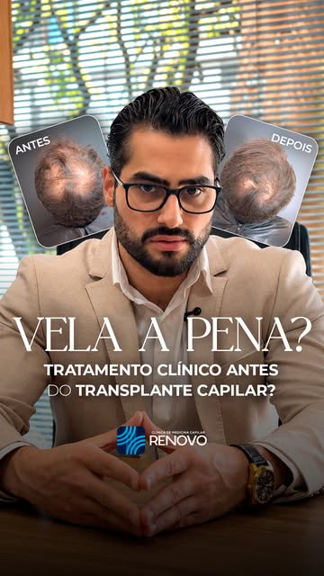 A eficácia do transplante capilar depende diretamente do preparo clínico pré-operatório.

O protocol