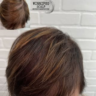 Winnipeg Scalp MicroPigmentation 
.
3 SMP sessions to complete a full density treatment 
.

Are you 