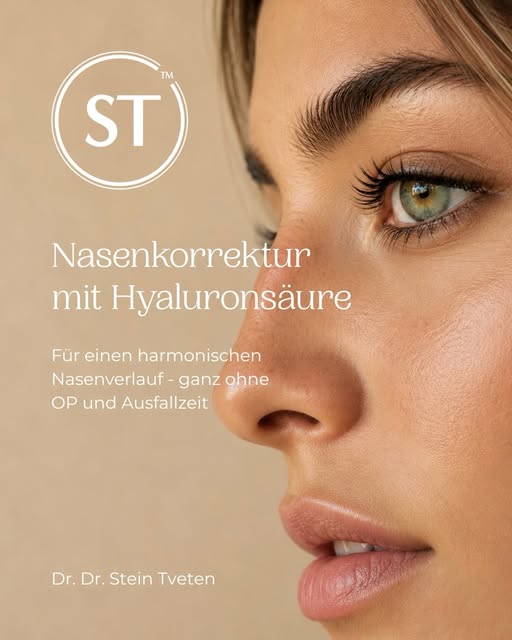 Harmonische Konturen - ganz ohne Operation⭐️

Eine Nasenkorrektur mit Hyaluronsäure bietet die Mögli