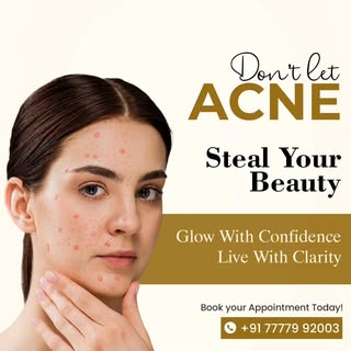 Clear skin starts with the right care ✨
Don’t let acne steal your confidence—get expert treatment to