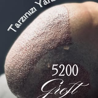 Taner EREN 5200 Greft İşlem Detayları !😎

Maksimum greft ile saçlarınızı geri kazandırıyor,
Bahar B