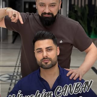 3000 Greft | Doğal Ön Hat Tasarımı 

Saç ekiminde en dikkat çeken detay, doğallığını koruyan bir ön 