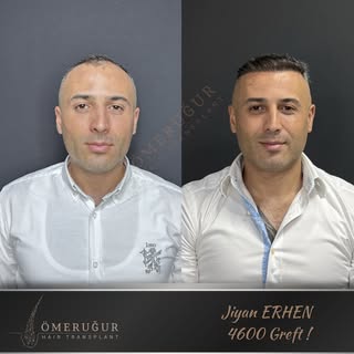🇪🇸 İspanya’dan gelen değerli danışanımız Jiyan ERHEN, tam 3 yıl önce gerçekleştirdiğimiz 4600 gref