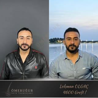 7. ayın sonunda, doğallık artık kendini hissettirmekle kalmıyor; dikkat çekiyor.

Titizlikle planlan