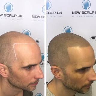 🎁Black Friday SMP Discounts! 
Limited Availability 

50% OFF website prices for NEW Scalp Micro Pig