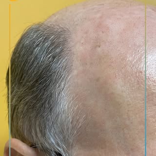 Recupera tu cabello con un resultado a otro nivel. ✨💇🏽‍♂️ ¡Date la oportunidad! 📞 787.590.4062 #J