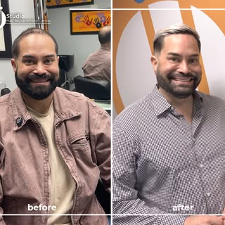 Amaury 1.0 vs. Amaury 2.0. ¿Cuántos años le quitamos? Déjanos saber en los comentarios. ⏳👇#JJHairRe