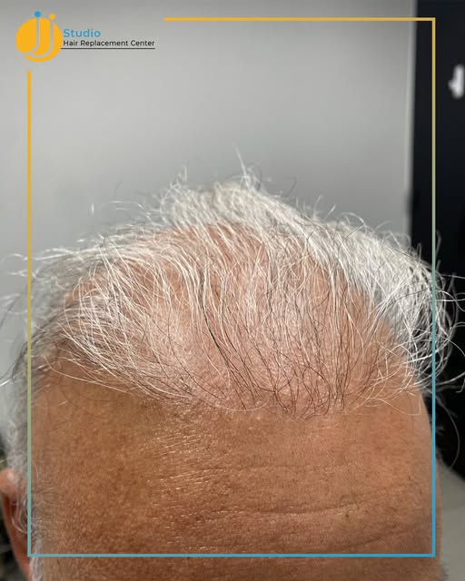 Del “dicho” al “hecho”, sin largo trecho. ¡Y bien hecho! 💬💇🏽‍♂️🚫🛣️
#JJHairReplacement #Tricolog