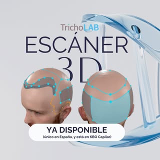 🚀Desde Polonia a Almería y de la mano de @tricholab, el único Escáner Capilar 3D en España, y lo ti