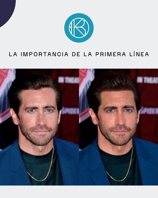 👀 En esta publicación os mostramos la diferencia entre una primera línea natural (izquierda) y otra