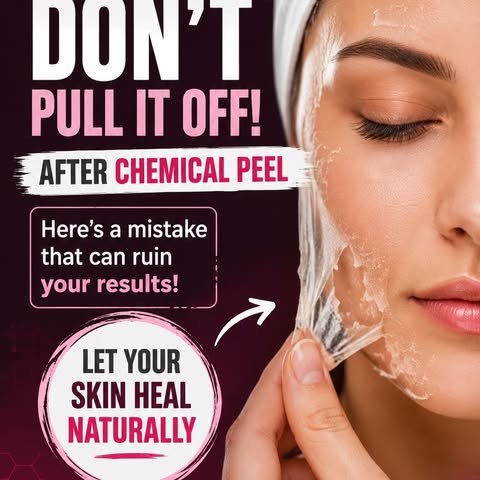 Had a Chemical Peel? Here's one mistake you should NEVER make! 🚫

After a chemical peel, it's compl