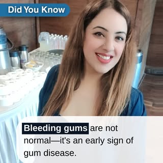 Bleeding gums are not normal ❌🦷
They’re often an early warning sign of gum disease—and ignoring the